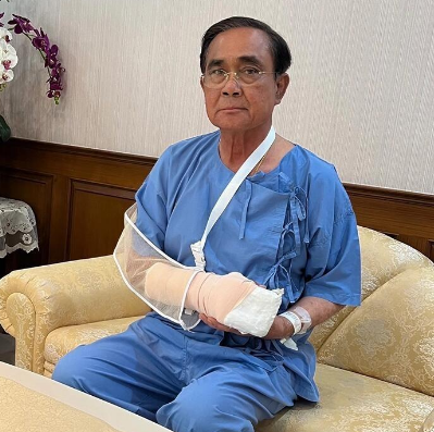 泰国总理巴育右手肿胀入院